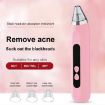 Blackhead Remover Vacuum Pore Cleaner - Pink - 3