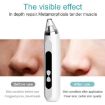 Blackhead Remover Vacuum Pore Cleaner - Pink - 6