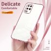 Silver Transparent Plating Case for Realme 8 5G - Fine Hole Design - 5