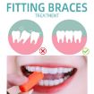 Fawnmum Handheld Orthodontic Bite Sticks (Strawberry) - 2pcs/Box - 2