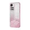 Xiaomi Redmi Note 11 Pro+ 5G Pink Glitter Gradient Phone Case - 1