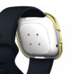 Fitbit Versa 3/Sense Gold Diamond PC Protective Case - Double Row Plating - 4