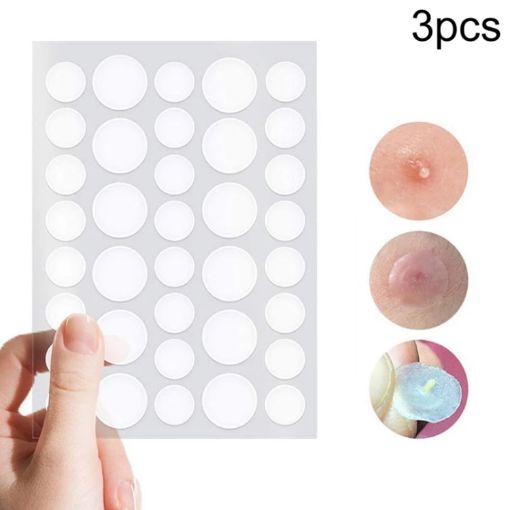 Acne Tool Set - 3 PCS Treatment for Scars & Pimples Stickers - 1