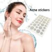 Acne Tool Set - 3 PCS Treatment for Scars & Pimples Stickers - 5