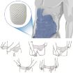 Skin Color Adult Hernia Belt Groin Protection - Supportive Brace - 6